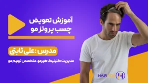 آموزش تعویض چسب پروتز مو