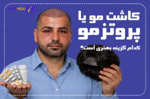 پروتزمو یا کاشت مو