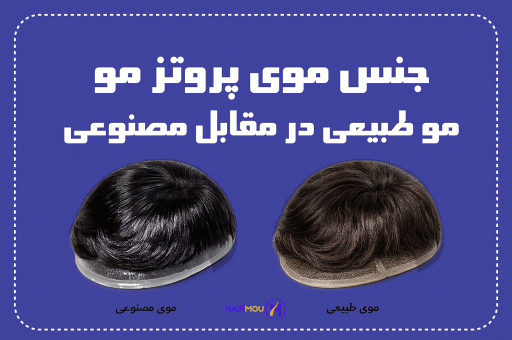 برسی جنس موی پروتز مو