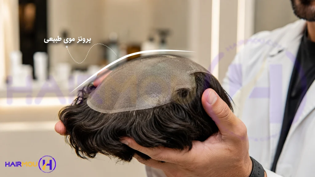 بهترین پروتز مو در شیراز