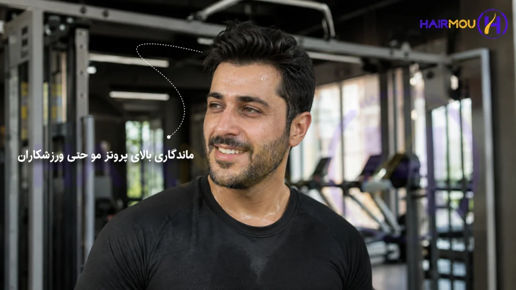 بهترین پروتز مو در شیراز