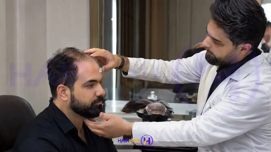 بهترین پروتز مو در ایران