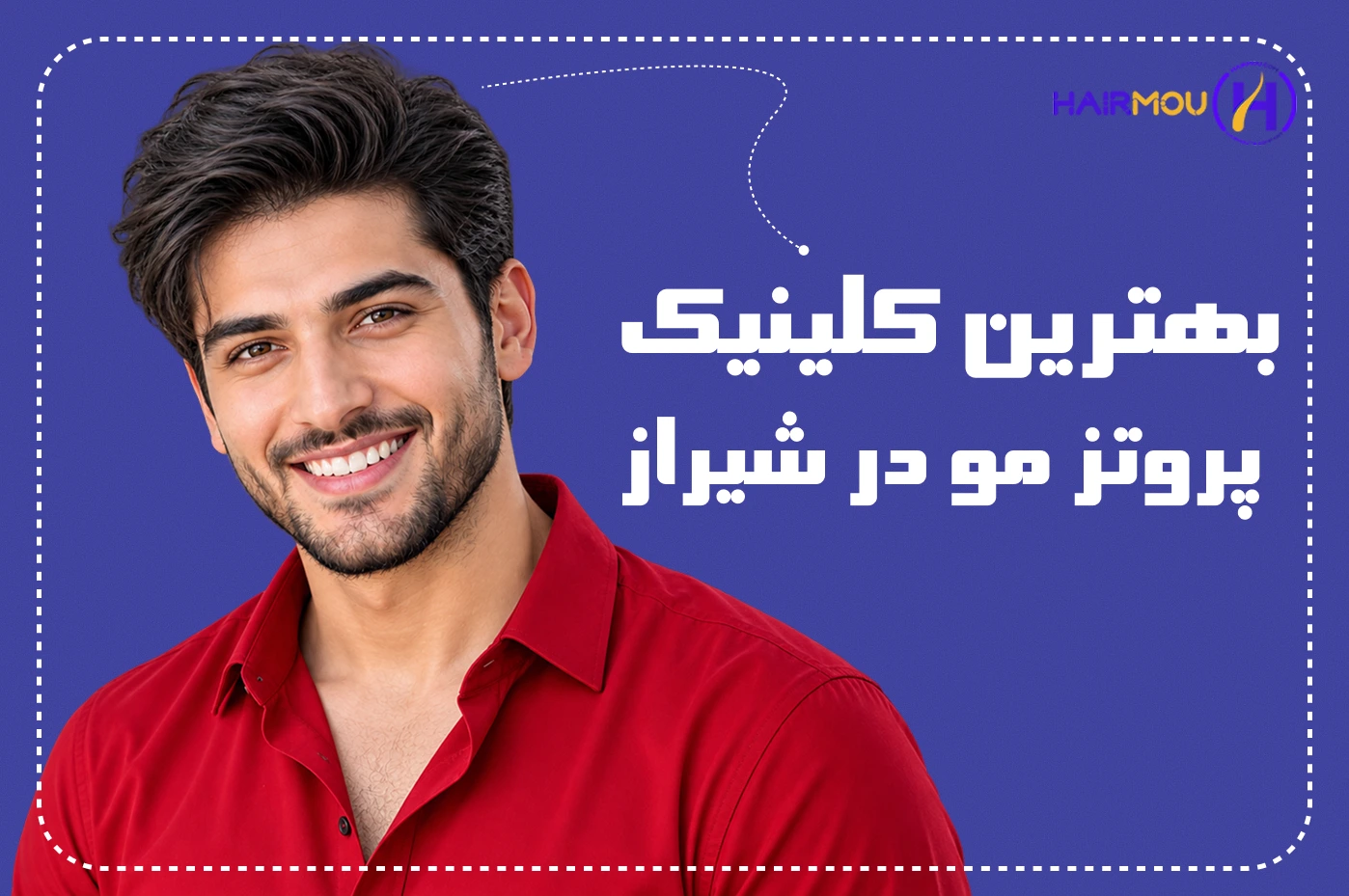 بهترین پروتز مو در شیراز