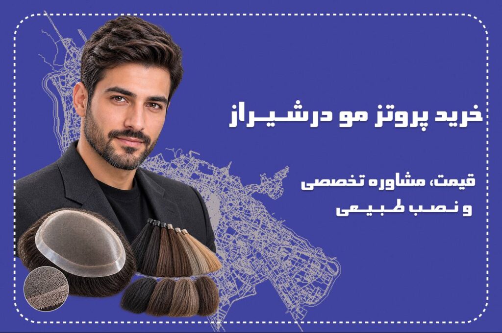 خرید پروتز مو در شیراز