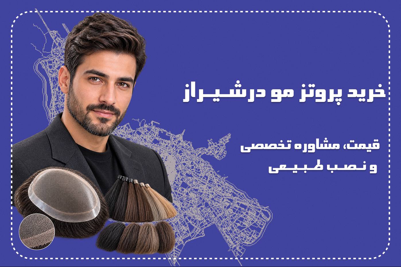 خرید پروتز مو در شیراز