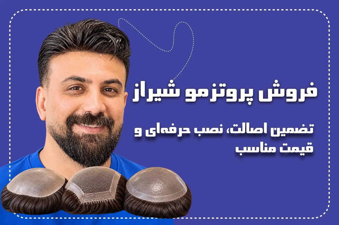 فروش پروتز مو شیراز