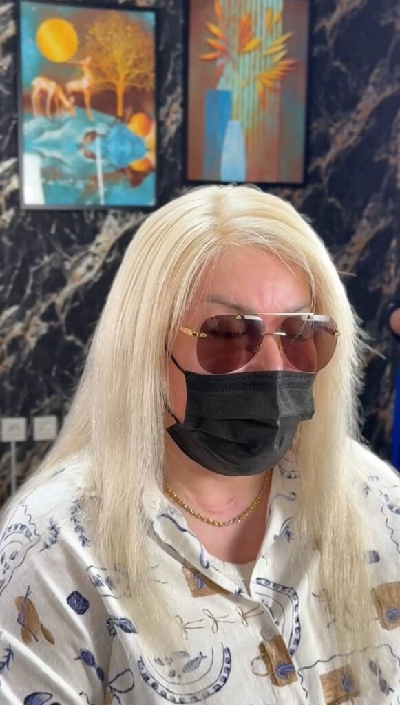 قیمت پروتز مو زنانه 