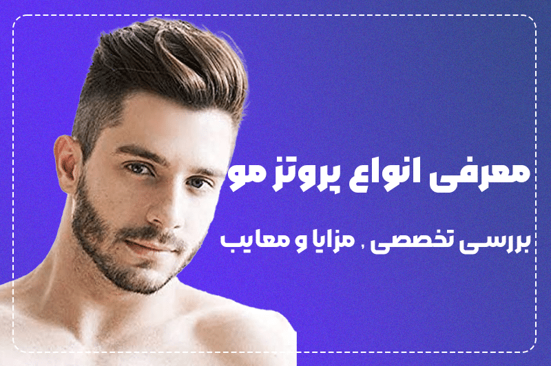 معرفی انواع پروتز مو